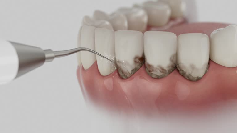 Trusted Wisdom Tooth Removal service in Tarrytown, NY - Dentist Open Now